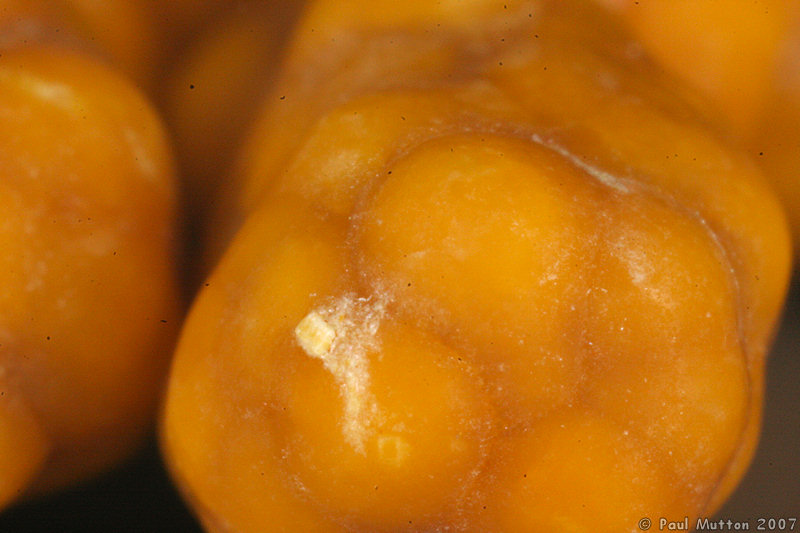 Gallstones Macro IMG 4608